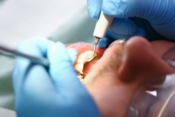 Best Walk-In Emergency Dentist in Plano, IL